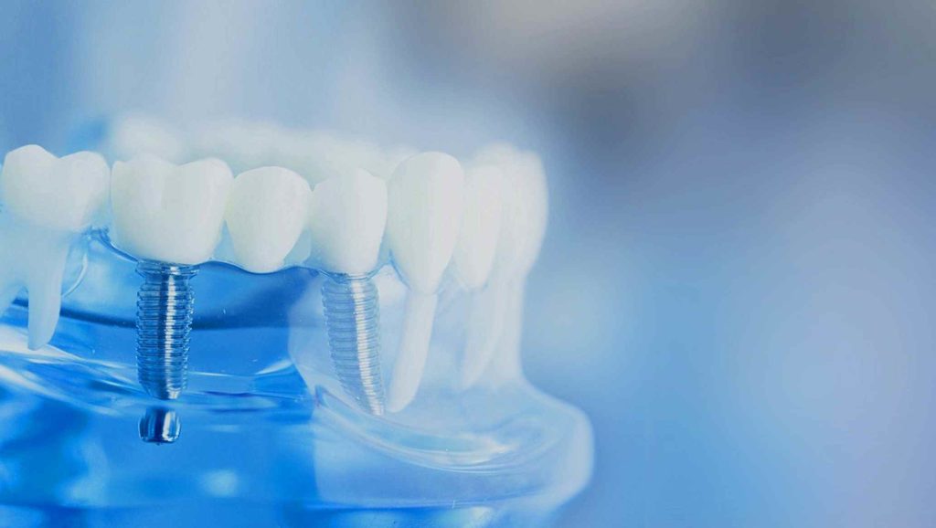 Diş büyüsü nedir?